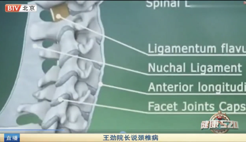 王劲院长说颈椎病