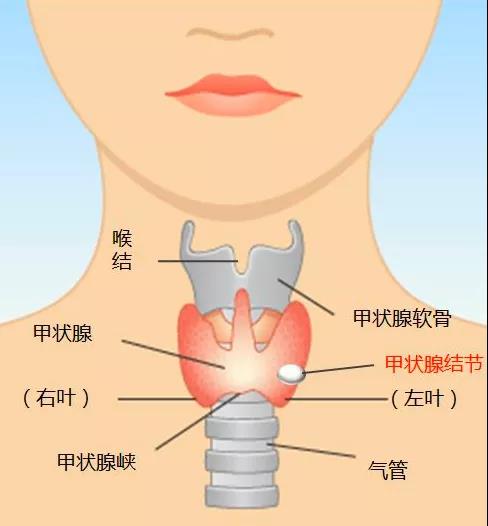 甲状腺结节.jpg